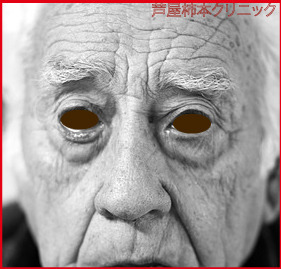 老人頬1.jpg