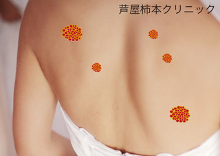背中.jpg