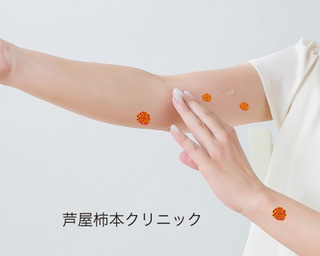 腕.jpg