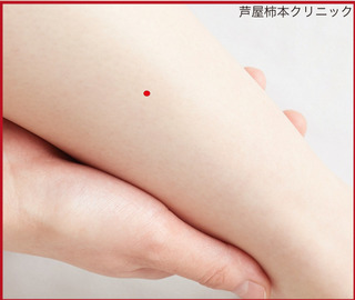 虫刺症1.jpg