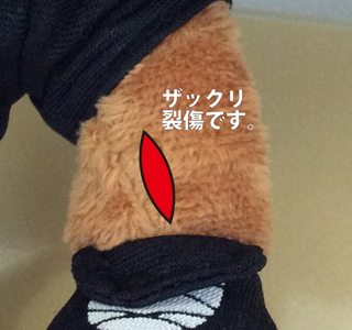裂傷2.jpg