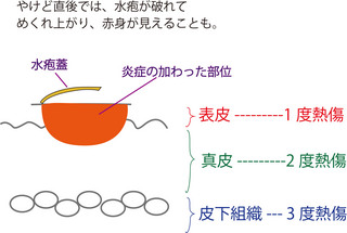 赤身見えてる.jpg