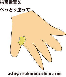 軟膏.jpg