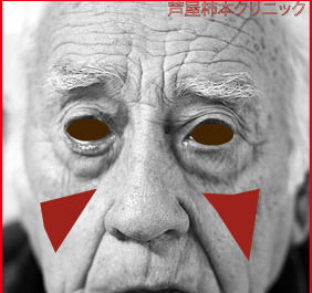 頬こけ.jpg