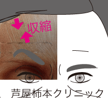 額2.gif
