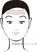 驚きじわ.gif