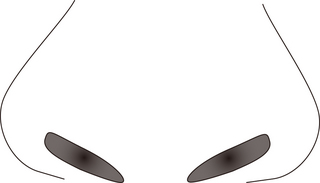 鼻のイボ.jpg