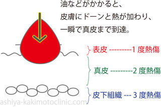 EFBC92E5BAA6E6B2B9E3818CE3818BE3818BE3828B-thumbnail2.jpg