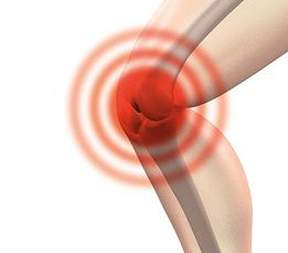 arthrocalman-2384253__480.jpg