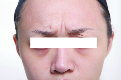 before2.jpg