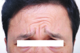 before3-97d92-thumbnail2.jpg