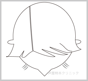 m字脱毛1.gif