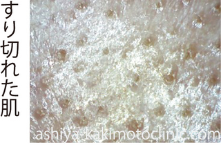 surikire4-thumbnail2.jpg