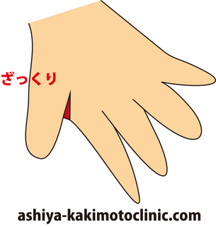 zakkuri.jpg